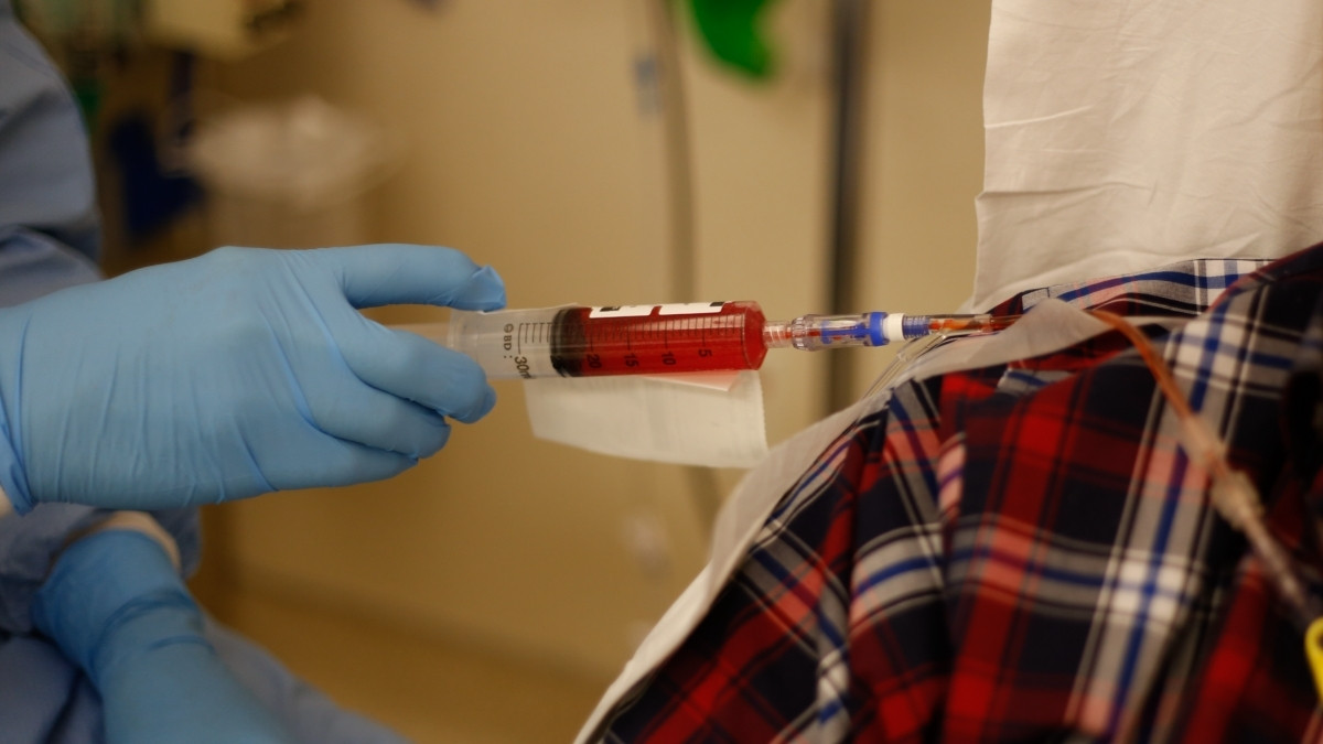 Selain Kanker, Penyakit Ini Bisa Diobati dengan Kemoterapi