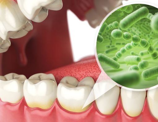 Penyebab Noda pada Gigi yang Jarang Diketahui