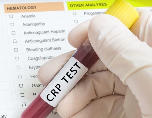 Mengenal Tes CRP (C-Reactive Protein) untuk Mendeteksi Penyakit