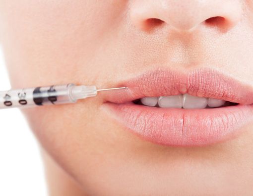 Menyingkap Cara Kerja dan Manfaat Suntik Filler