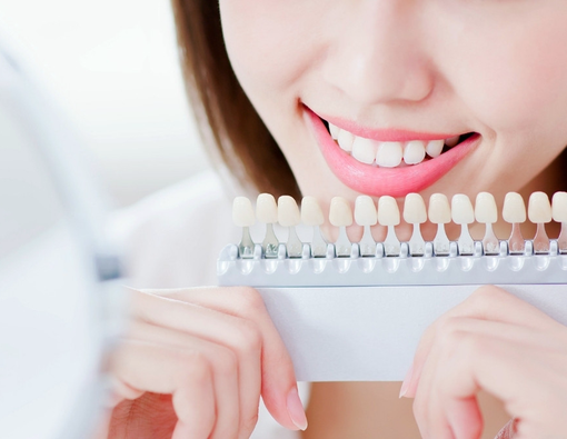 Veneer Gigi Bisa Menyebabkan Gusi Berdarah, Benarkah?