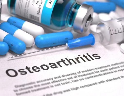 Untuk Osteoartritis, Lebih Baik Obat Oles atau Obat Minum?