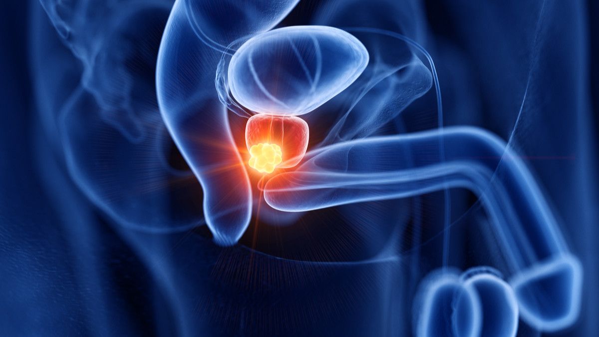 Mencegah Kanker Prostat dengan Makan Jamur, Efektifkah?