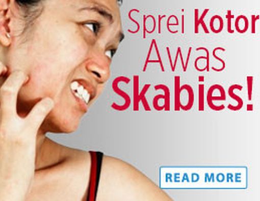 Sprei Kotor, Awas Skabies!