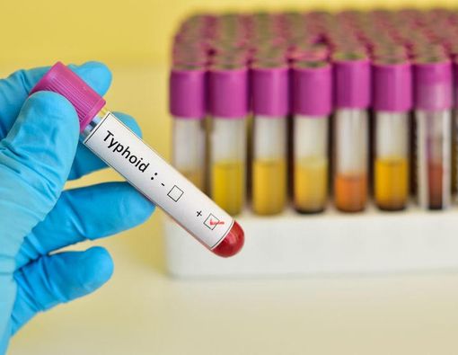 Cegah Demam Tifoid pada Musim Hujan