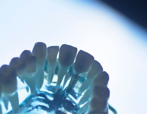 Gigi Palsu Longgar, Perlukah Membuat yang Baru?