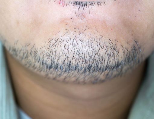 Adakah Manfaat Menumbuhkan Kumis dan Jenggot bagi Kesehatan Pria?