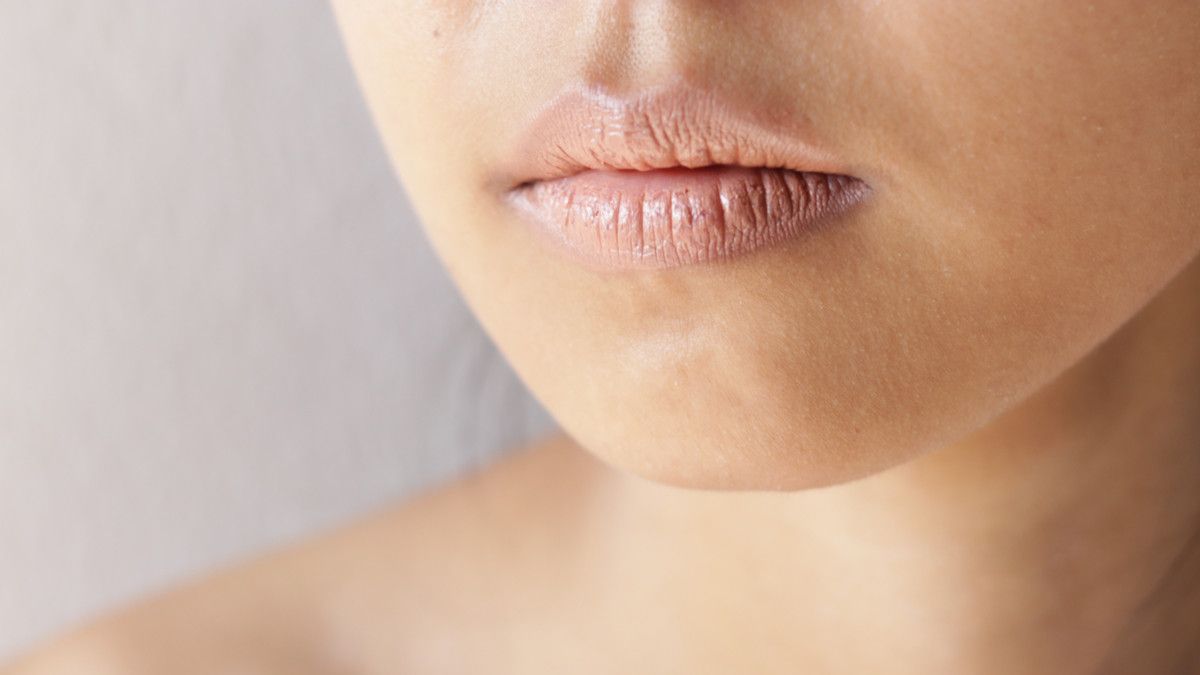 Penyebab Kulit di Sekitar Bibir Kering dan Cara Mengatasinya