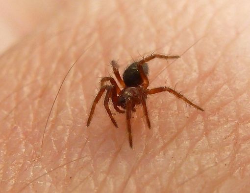 Infeksi Gigitan Laba-laba, Timbulkan Belatung pada Luka?