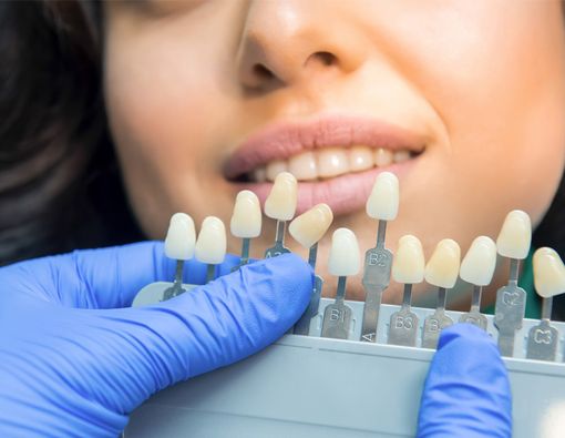 Susunan Gigi Tidak Normal, Kenali Maloklusi Gigi