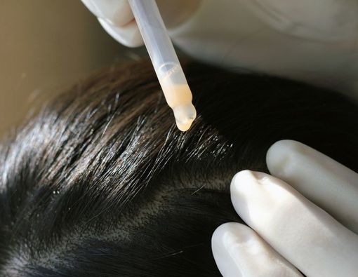 Mengenal Manfaat Detoks Rambut dan Kulit Kepala