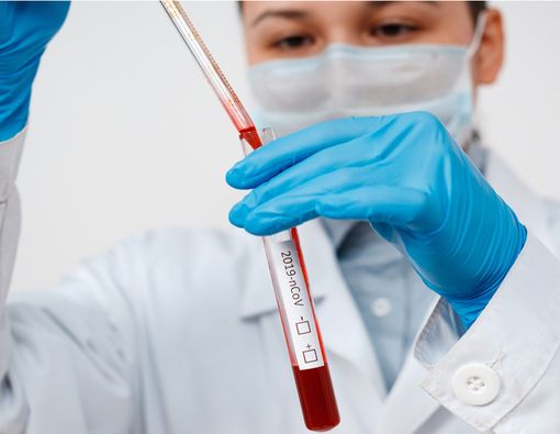 Virus Corona di Indonesia Berbeda dengan yang di Wuhan?