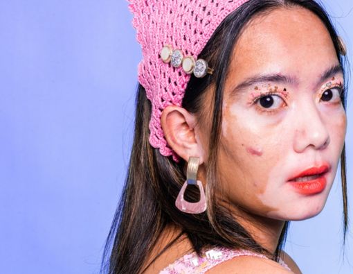 7 Penyebab dan Cara Menghilangkan Bercak Putih di Wajah