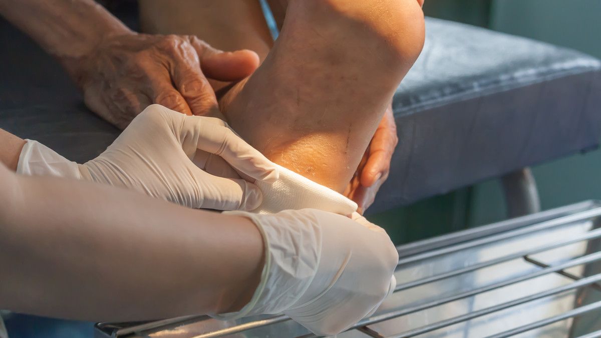 Dalam Kondisi Apa Luka (Kaki) Penderita Diabetes Harus Diamputasi?