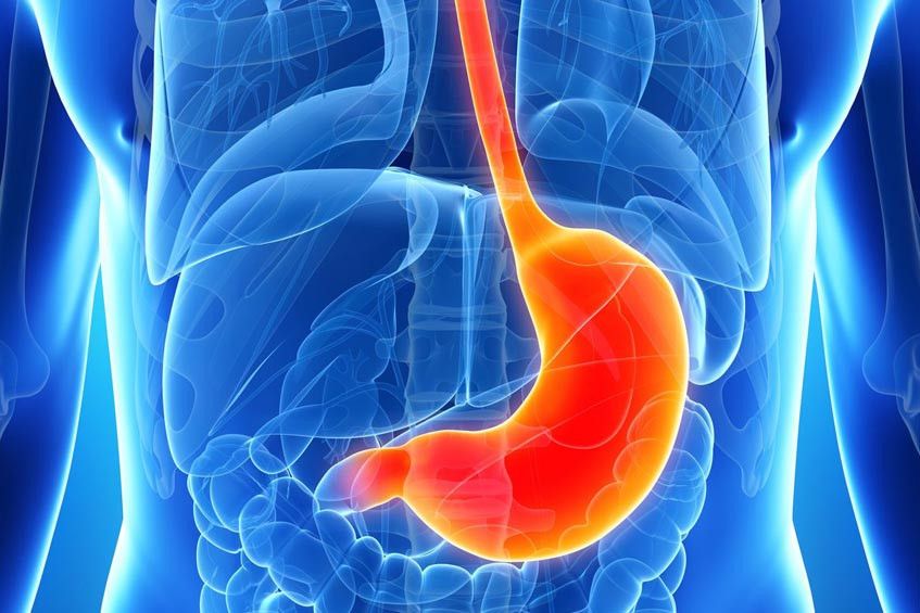 Operasi Ikat Lambung untuk Turunkan Berat Badan