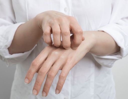 Mirip Eksim, Berikut 5 Gejala Scabies yang Perlu Diwaspadai