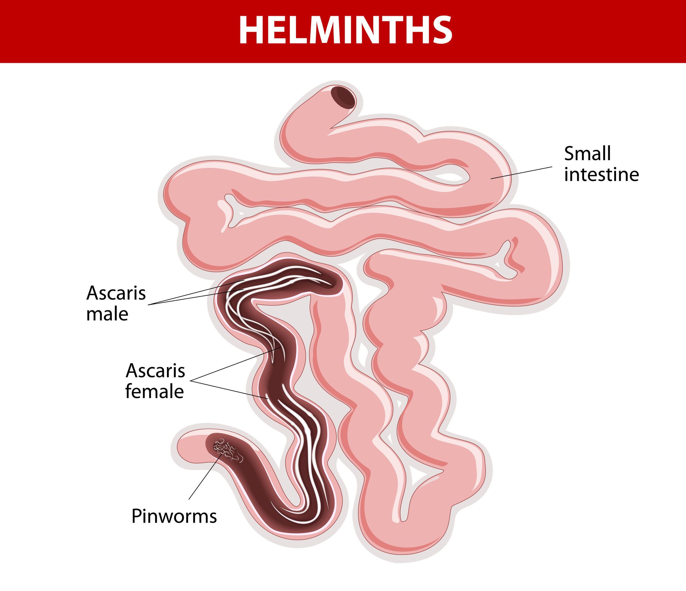 Apa Itu Cacing Kremi (Enterobiasis /Oksiuriasis)
