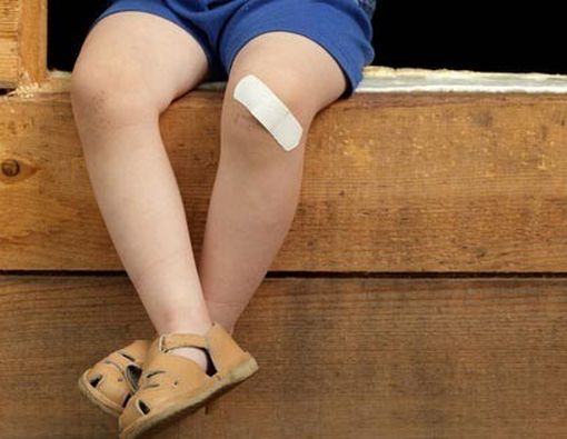 Cara Mengatasi Luka Lecet pada Anak