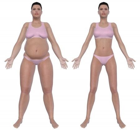 Perut Instan Rata dengan Tummy Tuck