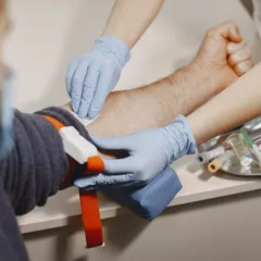 8 Penyebab Cuci Darah yang Perlu Diketahui