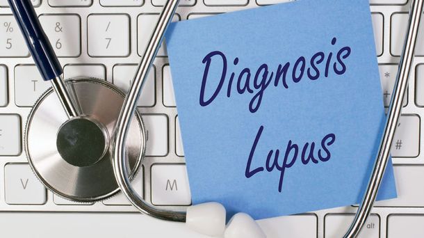 Mengenal Gejala Lupus, Penyakit Seribu Wajah yang Harus Diwaspadai
