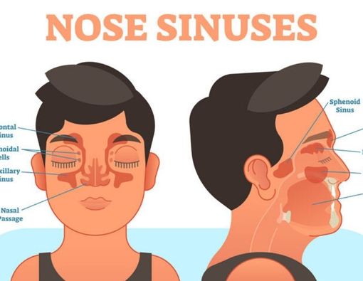 Penyebab Sakit Sinusitis seperti yang Dialami Shawn Mendes