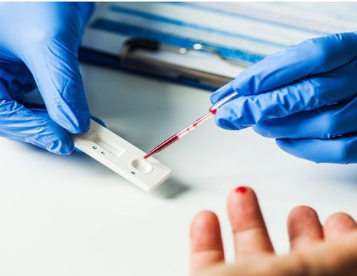 Melegakan, Kemenkes RI Putuskan Tarif Rapid Test Tertinggi 150 Ribu Saja!