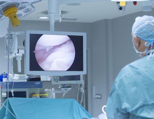 Serba-Serbi Operasi Polip Hidung