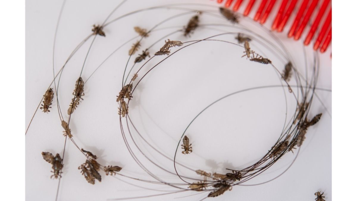 Manfaat Bawang Putih untuk Menghilangkan Kutu Rambut