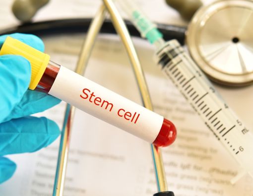 Perbedaan dan Contoh Penerapan Exosome, Secretome, dan Stem Cell