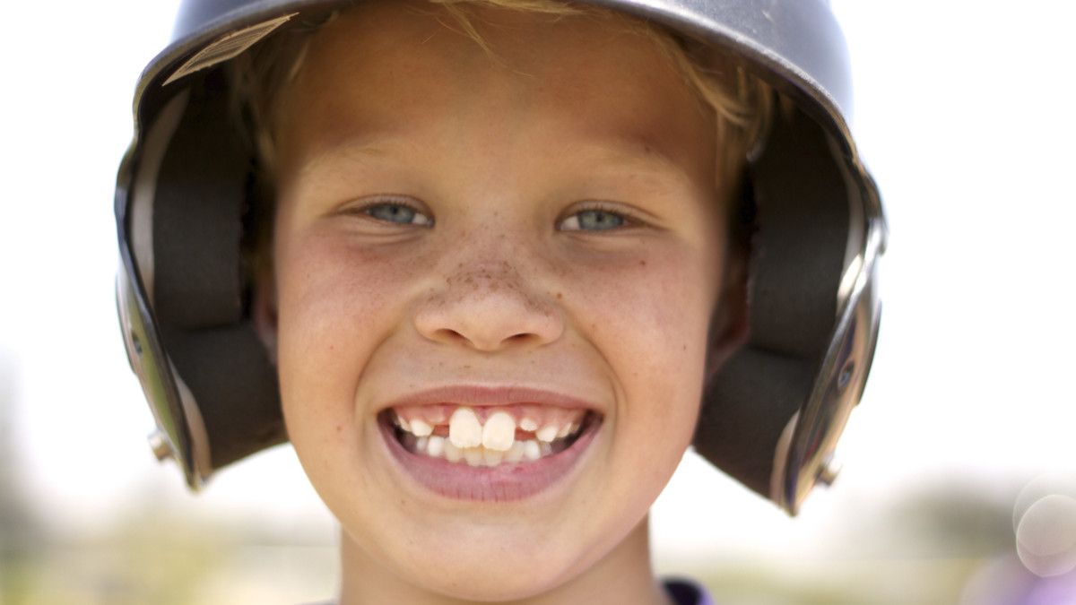 Kiat Cegah Gigi Tonggos pada Anak Sejak Kecil