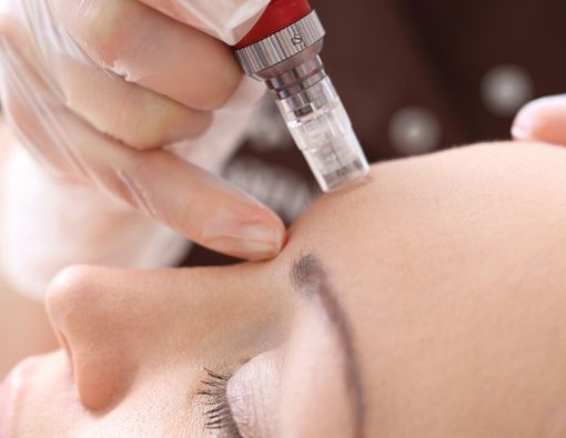 Waspada Bahaya Microneedling Makeup bagi Kulit Wajah