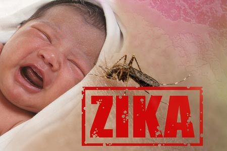 Bayi yang Terinfeksi Virus Zika Dapat Mengalami Kerusakan Mata