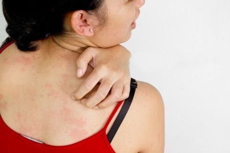 3 Penyakit yang Ditularkan Lewat Tangan