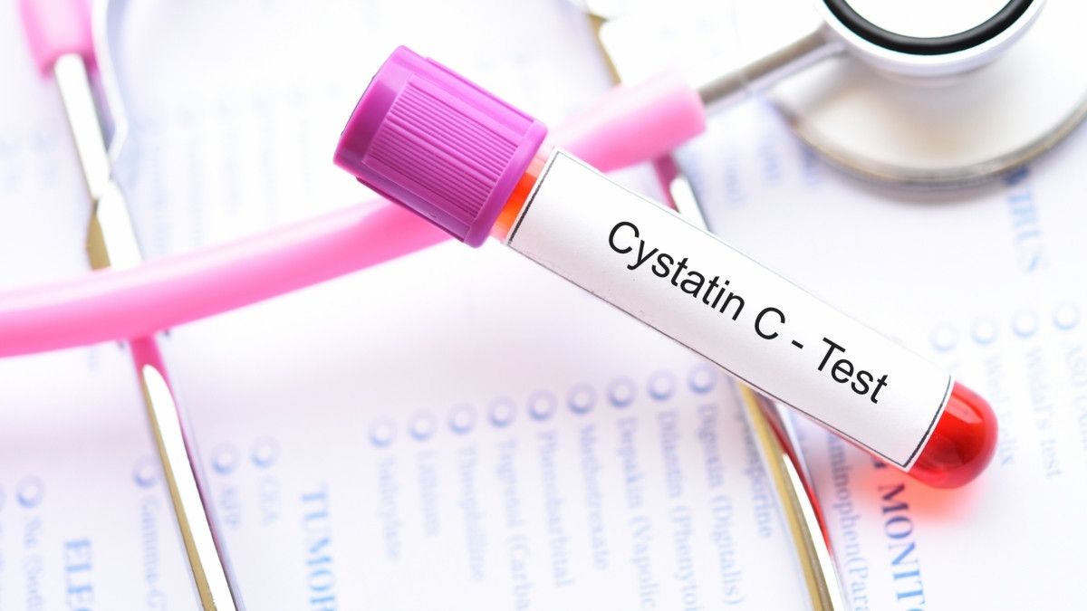 Tes Cystatin C untuk Mengetahui Gangguan Ginjal