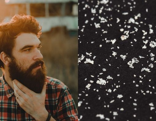 Cara Mengatasi Ketombe di Kumis dan Janggut