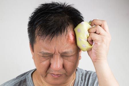 Kepala Anda Pernah Terbentur? Hati-Hati Alzheimer!