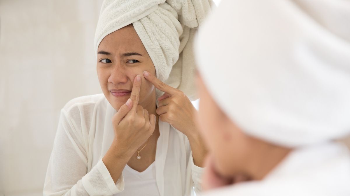 Mengapa Hidrokuinon Digunakan pada Skincare dan Cara Atasi Efeknya