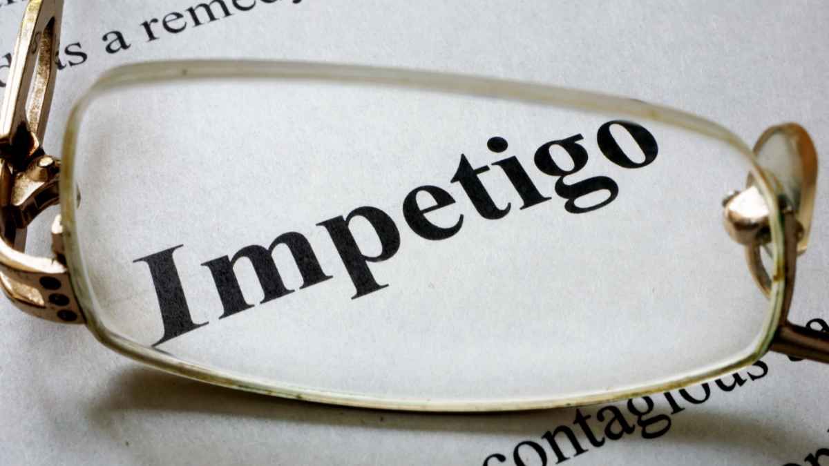 5 Gejala Penyakit Impetigo yang Bisa Dikenali
