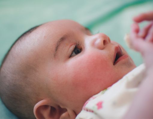 Menggunting Bulu Mata Bayi Agar Lentik, Efektif atau Berbahaya?