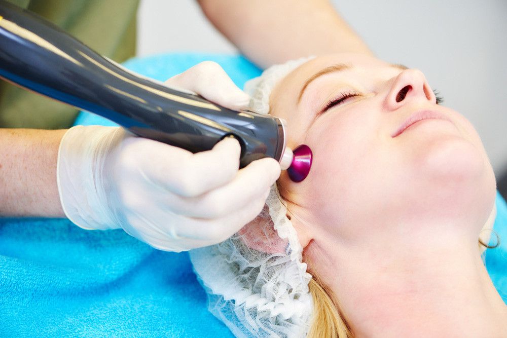 Kiat Jitu Menghilangkan Bekas Jerawat