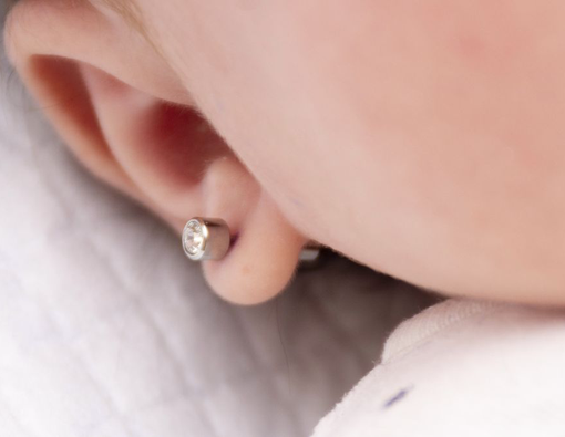 Cara Mengobati Luka Tindik Telinga yang Bernanah pada Bayi