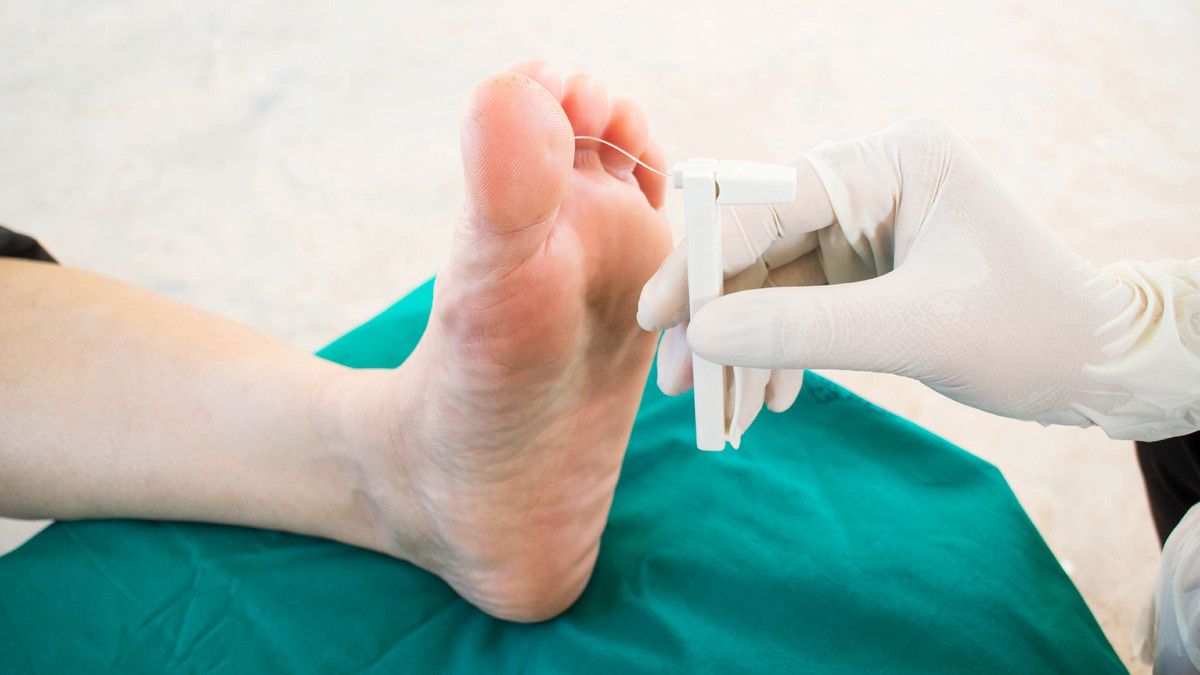 Anda Diabetes? Waspada Komplikasi Luka Kaki Diabetes