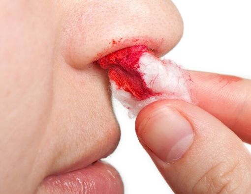 Mimisan saat Terangsang seperti di Kartun, Benarkah Bisa Begitu?