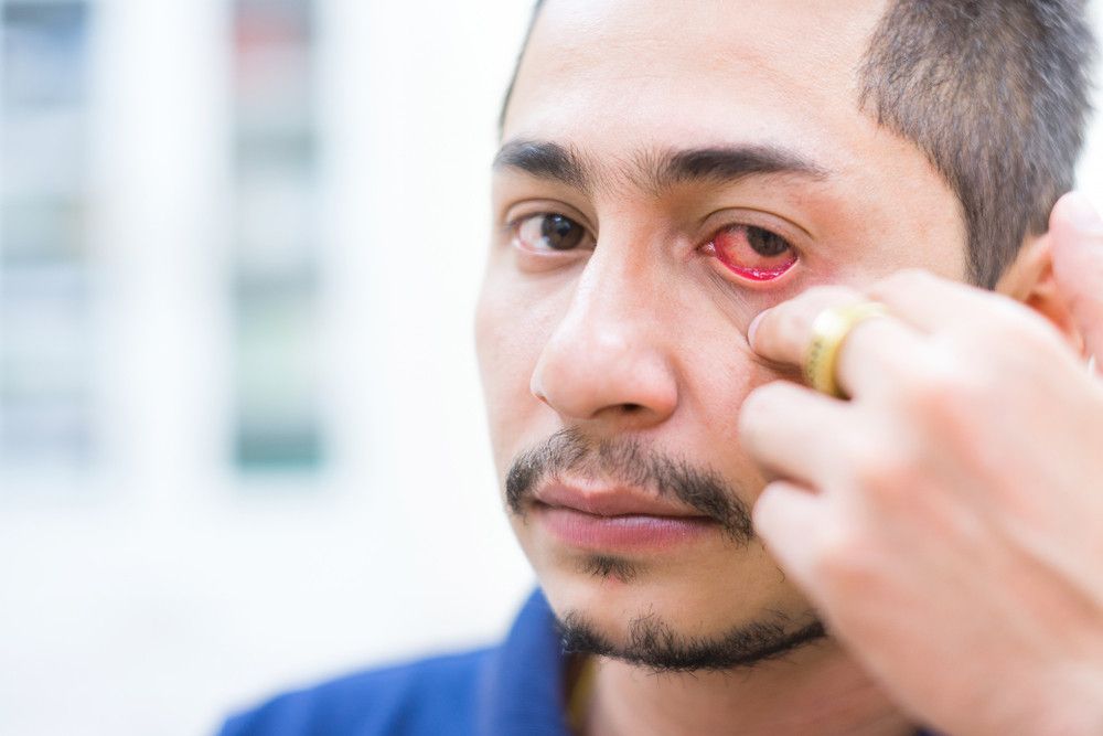 Benarkah Obat Disfungsi Ereksi Picu Gangguan pada Mata?