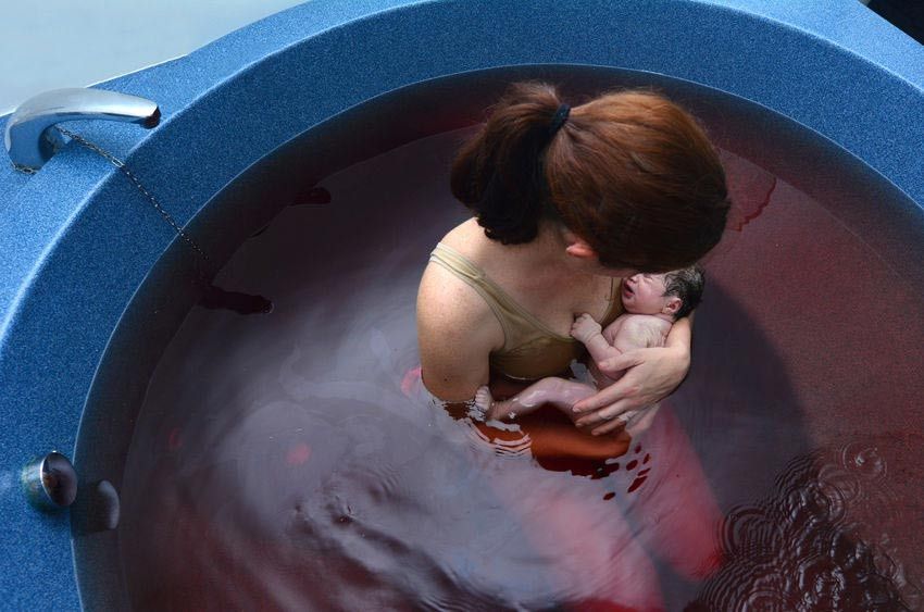 Menilik Keuntungan dan Risiko Water Birth