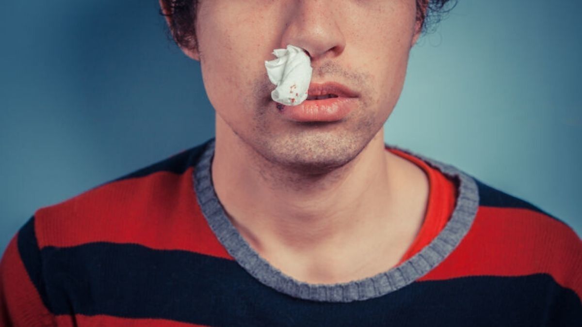 Tak Perlu Panik, Kenali Penyebab Hidung Berdarah