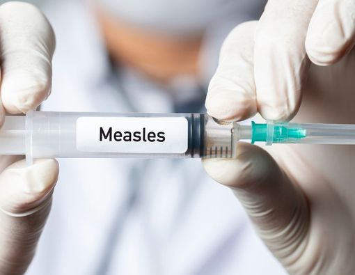 Belum Imunisasi Bayi Sudah Kena Campak, Lakukan Hal Ini