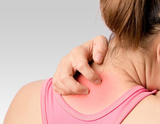 8 Penyebab Jerawat di Leher dan Cara Ampuh Mengatasinya