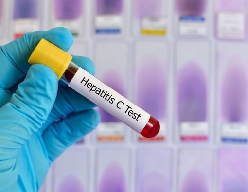 Kondisi Serius Akibat Hepatitis C yang Tak Diobati